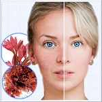 Rhodofiltrat Palmaria (Родофильтрат Пальмариа), 20 г - протектор псориаза и венотоник Rhodofiltrat Palmaria (Родофильтрат Пальмариа), 20 г - протектор псориаза и венотоник