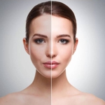 AZELOGLICINA (Азелоглицин) ОПТ AZELOGLICINA (Азелоглицин) ОПТ