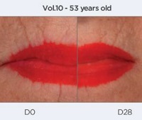 SWT-7L™- Сверциамарин для борьбы с кисетными морщинами SWT-7L™- Сверциамарин для борьбы с кисетными морщинами