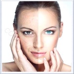 Seboreductyl (Себоредуктил) - регуляция синтеза и выделения кожного сала, 10 г Seboreductyl (Себоредуктил) - регуляция синтеза и выделения кожного сала, 10 г