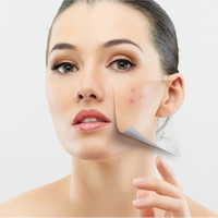 Азелаиновая кислота (Azelaic acid), 10 г Азелаиновая кислота (Azelaic acid), 10 г